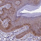 Anti-ITGB4 antibody produced in rabbit Prestige Antibodies&#174; Powered by Atlas Antibodies, affinity isolated antibody, buffered aqueous glycerol solution