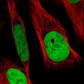 Anti-RCC1 antibody produced in rabbit Prestige Antibodies&#174; Powered by Atlas Antibodies, affinity isolated antibody, buffered aqueous glycerol solution, ab1