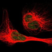 抗EIF2AK1抗体 ウサギ宿主抗体 Prestige Antibodies&#174; Powered by Atlas Antibodies, affinity isolated antibody, buffered aqueous glycerol solution