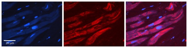 Anti-ALAD (AB2) antibody produced in rabbit affinity isolated antibody