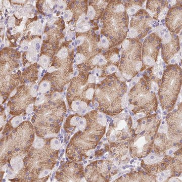 Anti-ADAM8 antibody produced in rabbit Prestige Antibodies&#174; Powered by Atlas Antibodies, affinity isolated antibody, buffered aqueous glycerol solution