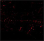 Anti-LGI1 (ab1) antibody produced in rabbit affinity isolated antibody, buffered aqueous solution