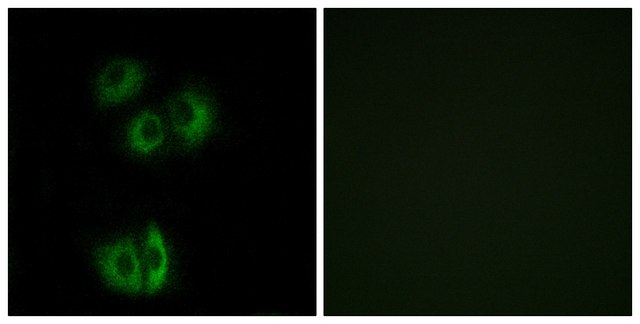 Anti-CELSR3 antibody produced in rabbit affinity isolated antibody