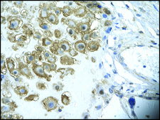 Anti-ENO1 antibody produced in rabbit affinity isolated antibody