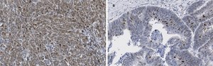 Anti-phospho-Smad2 (Ser465/467) Antibody, clone A5S, ZooMAb&#174; Rabbit Monoclonal recombinant, expressed in HEK 293 cells