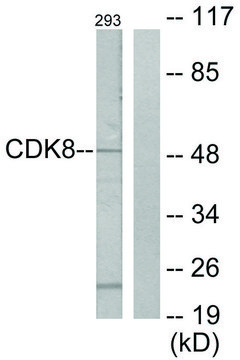 Anti-CDK8 antibody produced in rabbit affinity isolated antibody