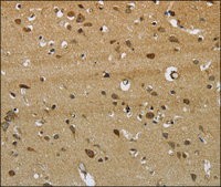 Anti-ITPR3 antibody produced in rabbit affinity isolated antibody