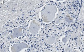 Anti-MRGPRX2 Antibody, clone 1O10 ZooMAb&#174; Rabbit Monoclonal recombinant, expressed in HEK 293 cells