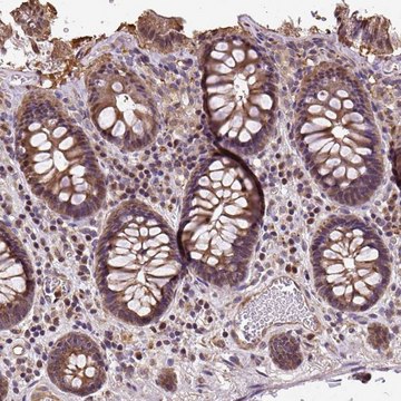 Anti-PUS7L antibody produced in rabbit Prestige Antibodies&#174; Powered by Atlas Antibodies, affinity isolated antibody, buffered aqueous glycerol solution