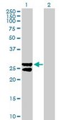 Anti-MMAB antibody produced in mouse purified immunoglobulin, buffered aqueous solution