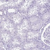 Anti-KRT10 antibody produced in rabbit Prestige Antibodies&#174; Powered by Atlas Antibodies, affinity isolated antibody, buffered aqueous glycerol solution