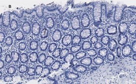 Anti-trimethyl-Histone H3 (Lys4) Antibody, clone MC315, ZooMAb&#174; Rabbit Monoclonal recombinant, expressed in HEK 293 cells