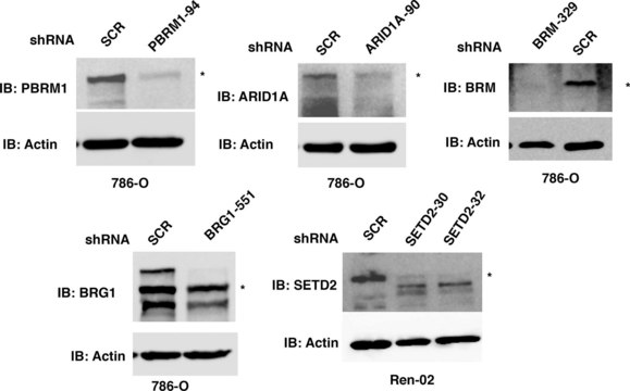 Anti-ARID1A antibody produced in rabbit Prestige Antibodies&#174; Powered by Atlas Antibodies, affinity isolated antibody, buffered aqueous glycerol solution