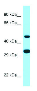 Anti-SCD5 (C-terminal) antibody produced in rabbit affinity isolated antibody