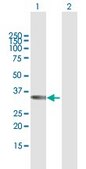 Anti-TBX20 antibody produced in mouse purified immunoglobulin, buffered aqueous solution