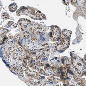 Anti-KIAA1462 antibody produced in rabbit Prestige Antibodies&#174; Powered by Atlas Antibodies, affinity isolated antibody, buffered aqueous glycerol solution