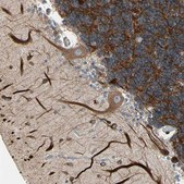 Anti-MAP2 antibody produced in rabbit affinity isolated antibody, buffered aqueous glycerol solution