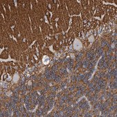 Anti-STXBP1 antibody produced in rabbit Prestige Antibodies&#174; Powered by Atlas Antibodies, affinity isolated antibody, buffered aqueous glycerol solution