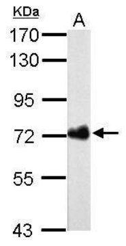 Monoclonal Anti-Urease B antibody produced in mouse clone GT962, affinity isolated antibody