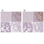 Anti-PAEP antibody produced in rabbit Prestige Antibodies&#174; Powered by Atlas Antibodies, affinity isolated antibody, buffered aqueous glycerol solution