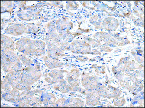 Anti-RASA1 affinity isolated antibody