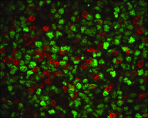Monoclonal Anti-Proliferating Cell Nuclear Antigen antibody produced in mouse clone PC 10, ascites fluid