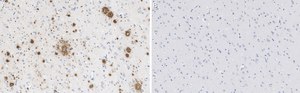 Anti-Amyloid &#946;42/40 Antibody, clone W0-2 ZooMAb&#174; Mouse Monoclonal recombinant, expressed in HEK 293 cells