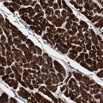 Anti-Plod3 Antibody Produced In Rabbit Prestige Antibodies&#174; Powered by Atlas Antibodies, affinity isolated antibody, buffered aqueous glycerol solution