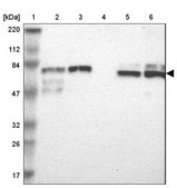 Anti-TRIM25 antibody produced in rabbit Prestige Antibodies&#174; Powered by Atlas Antibodies, affinity isolated antibody, buffered aqueous glycerol solution