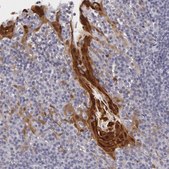 Anti-IL1RN antibody produced in rabbit Prestige Antibodies&#174; Powered by Atlas Antibodies, affinity isolated antibody, buffered aqueous glycerol solution