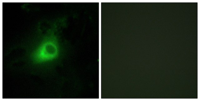 Anti-GRK6 antibody produced in rabbit affinity isolated antibody
