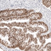 Anti-CDX2 antibody produced in mouse Prestige Antibodies&#174; Powered by Atlas Antibodies, clone CL12974, purified by using Protein A, buffered aqueous glycerol solution