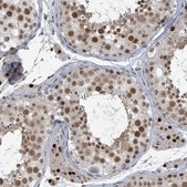Anti-UCK1 antibody produced in rabbit Prestige Antibodies&#174; Powered by Atlas Antibodies, affinity isolated antibody, buffered aqueous glycerol solution
