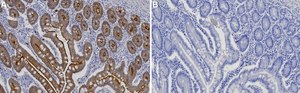 Anti-MYH14/Myosin-14 Antibody, clone 2B4 ZooMAb&#174; Rabbit Monoclonal recombinant, expressed in HEK 293 cells