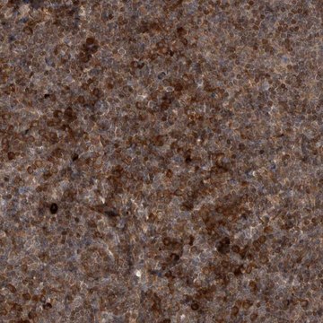 Anti-RAB3GAP2 antibody produced in rabbit Prestige Antibodies&#174; Powered by Atlas Antibodies, affinity isolated antibody, buffered aqueous glycerol solution, Ab2