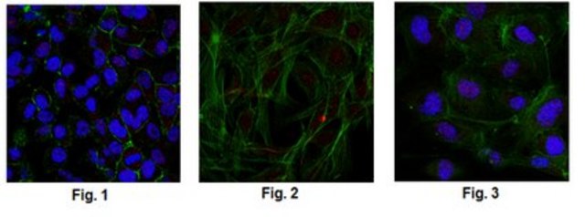 Anti-Ser/Thr-protein kinase Nek2 Antibody, clone 5D2.1 clone 5D2.1, from mouse