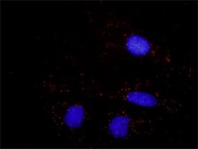 Monoclonal Anti-B2M antibody produced in mouse clone 3F9-2C2, purified immunoglobulin, buffered aqueous solution