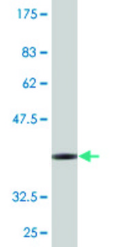 Monoclonal Anti-SGCG, (C-terminal) antibody produced in mouse clone 3C5, purified immunoglobulin, buffered aqueous solution