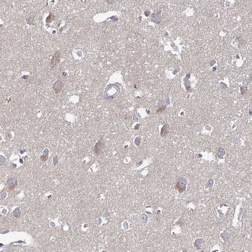 Anti-ARHGAP44 antibody produced in rabbit Prestige Antibodies&#174; Powered by Atlas Antibodies, affinity isolated antibody, buffered aqueous glycerol solution