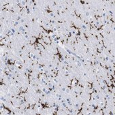 Anti-P2RY12 antibody produced in rabbit Prestige Antibodies&#174; Powered by Atlas Antibodies, affinity isolated antibody, buffered aqueous glycerol solution