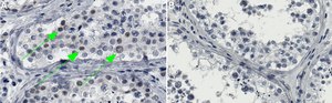 Anti-DNMT3B Antibody, clone 2N12 ZooMAb&#174; Rabbit Monoclonal recombinant, expressed in HEK 293 cells