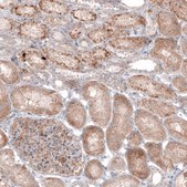 Monoclonal Anti--G6PC antibody produced in mouse Prestige Antibodies&#174; Powered by Atlas Antibodies, clone CL5817, purified immunoglobulin, buffered aqueous glycerol solution
