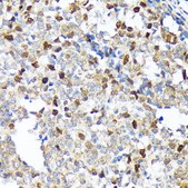 Anti-KIFC1 Antibody, clone 10M10J4, Rabbit Monoclonal