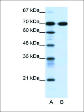 Anti-RRN3 (AB1) antibody produced in rabbit affinity isolated antibody