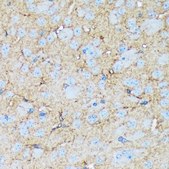 Anti-Versican antibody produced in rabbit
