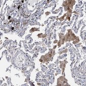 Anti-SLCO4A1 antibody produced in rabbit Prestige Antibodies&#174; Powered by Atlas Antibodies, affinity isolated antibody, buffered aqueous glycerol solution