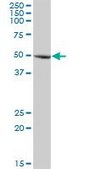 Anti-GLMN antibody produced in mouse purified immunoglobulin, buffered aqueous solution