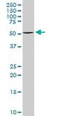 Anti-TYR antibody produced in rabbit purified immunoglobulin, buffered aqueous solution