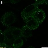 Anti-TrkB Antibody, clone 3E18 ZooMAb&#174; Rabbit Monoclonal recombinant, expressed in HEK 293 cells