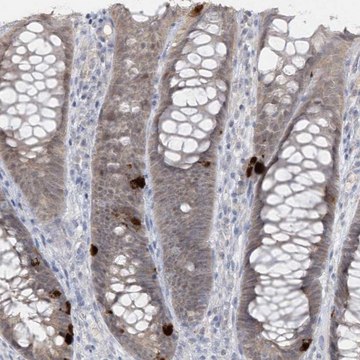Anti-PCBD1 antibody produced in rabbit Prestige Antibodies&#174; Powered by Atlas Antibodies, affinity isolated antibody, buffered aqueous glycerol solution